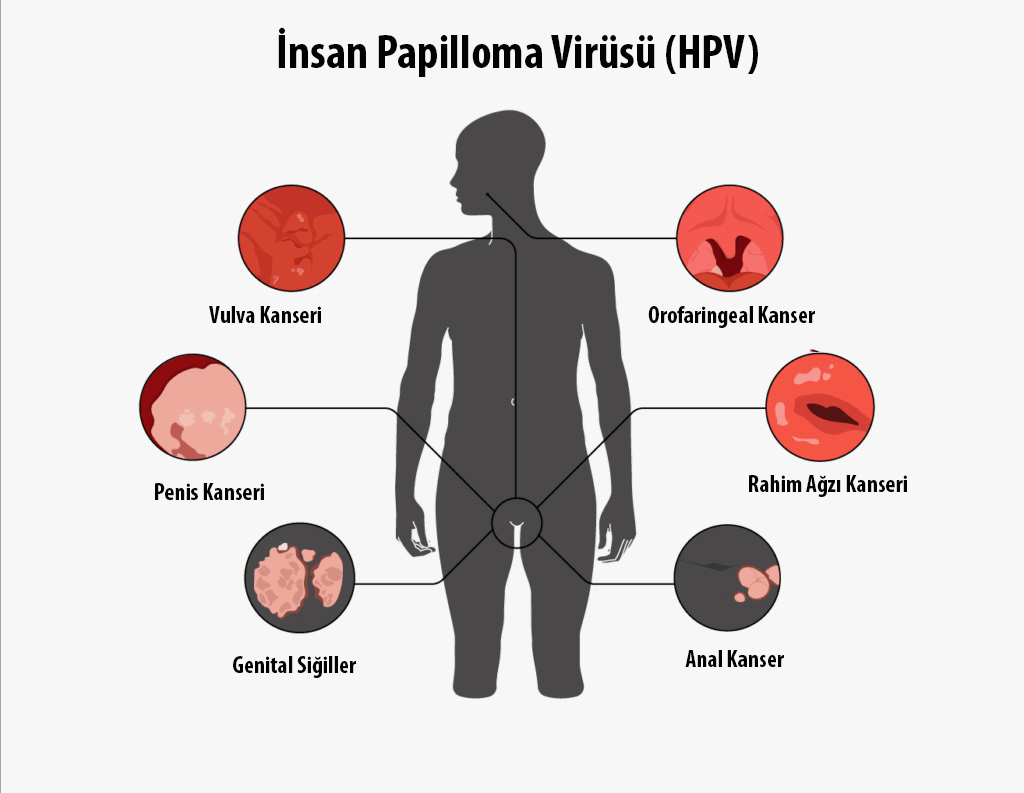 HPV Belirtileri