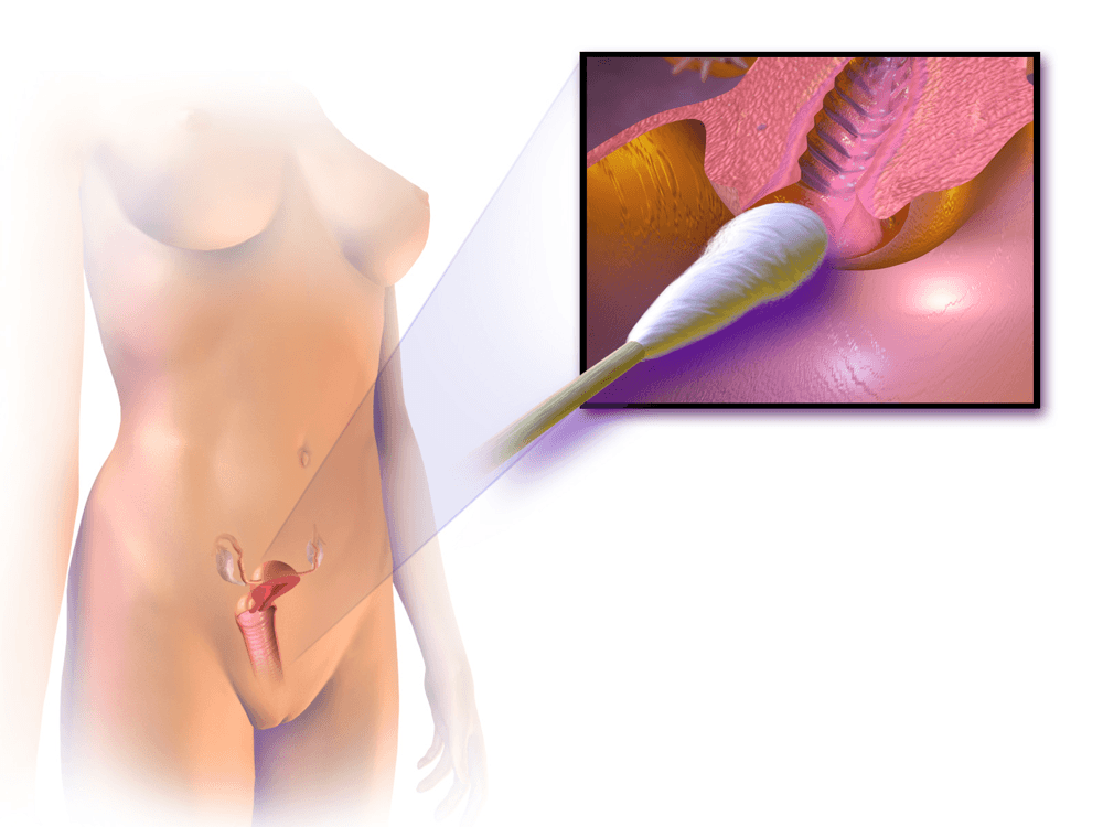 pap smear testi nasıl yapılır