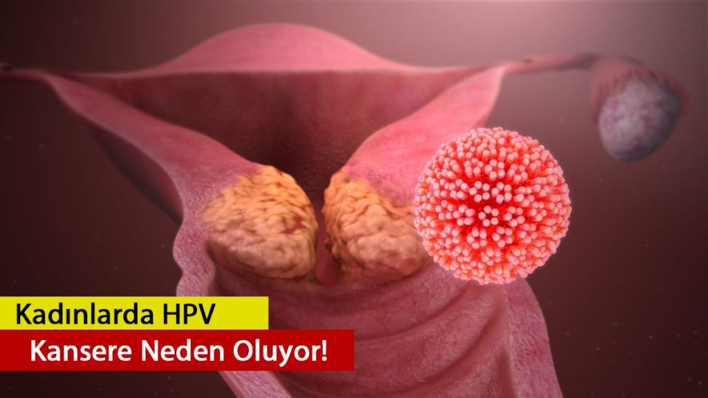 dikkat! hpv kansere neden oluyor